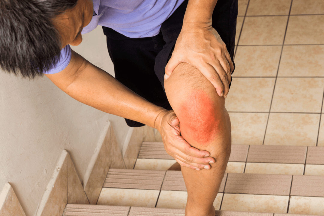 Joint pain due to arthritis