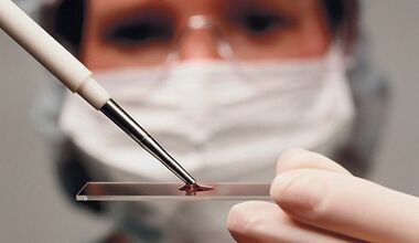 Differentiate diagnosis of properties and muscle diseases