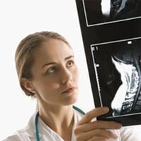 Diagnosis of osteoarthritis is indicated by using x -ray