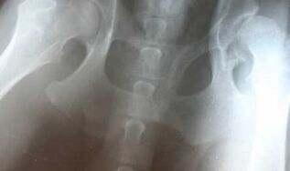 symptoms and treatment of hip joint disease